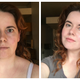 Aimee before, after.